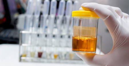 Biomarcadores urinários no diagnóstico da apneia obstrutiva do sono pediátrica